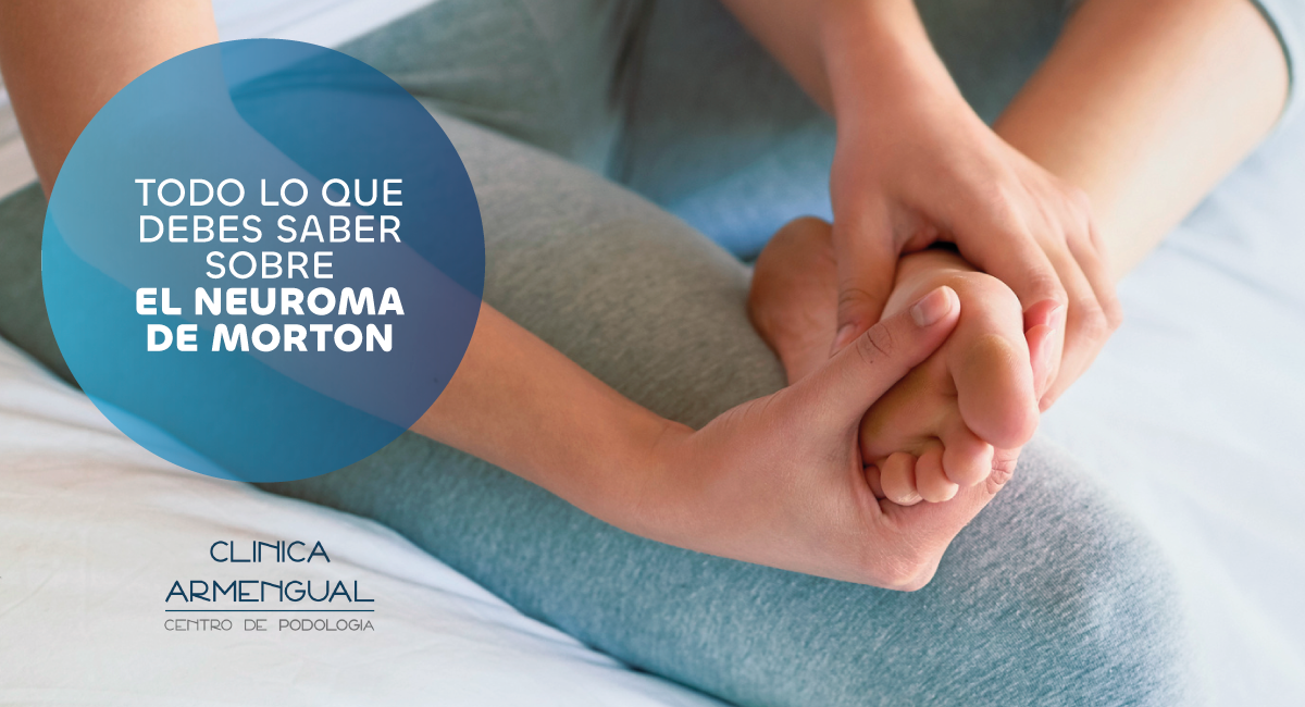 Planta de pie inflamada, Neuroma de Morton